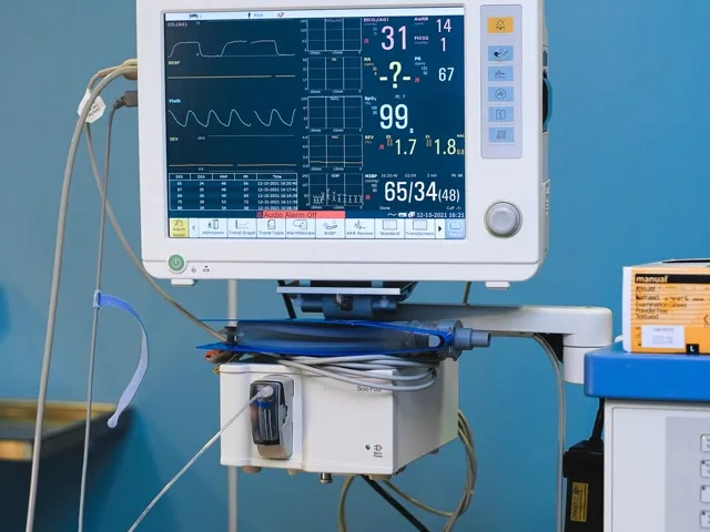 Betegmonitor közelről, vitális paraméterek és EKG-görbék kijelzésével